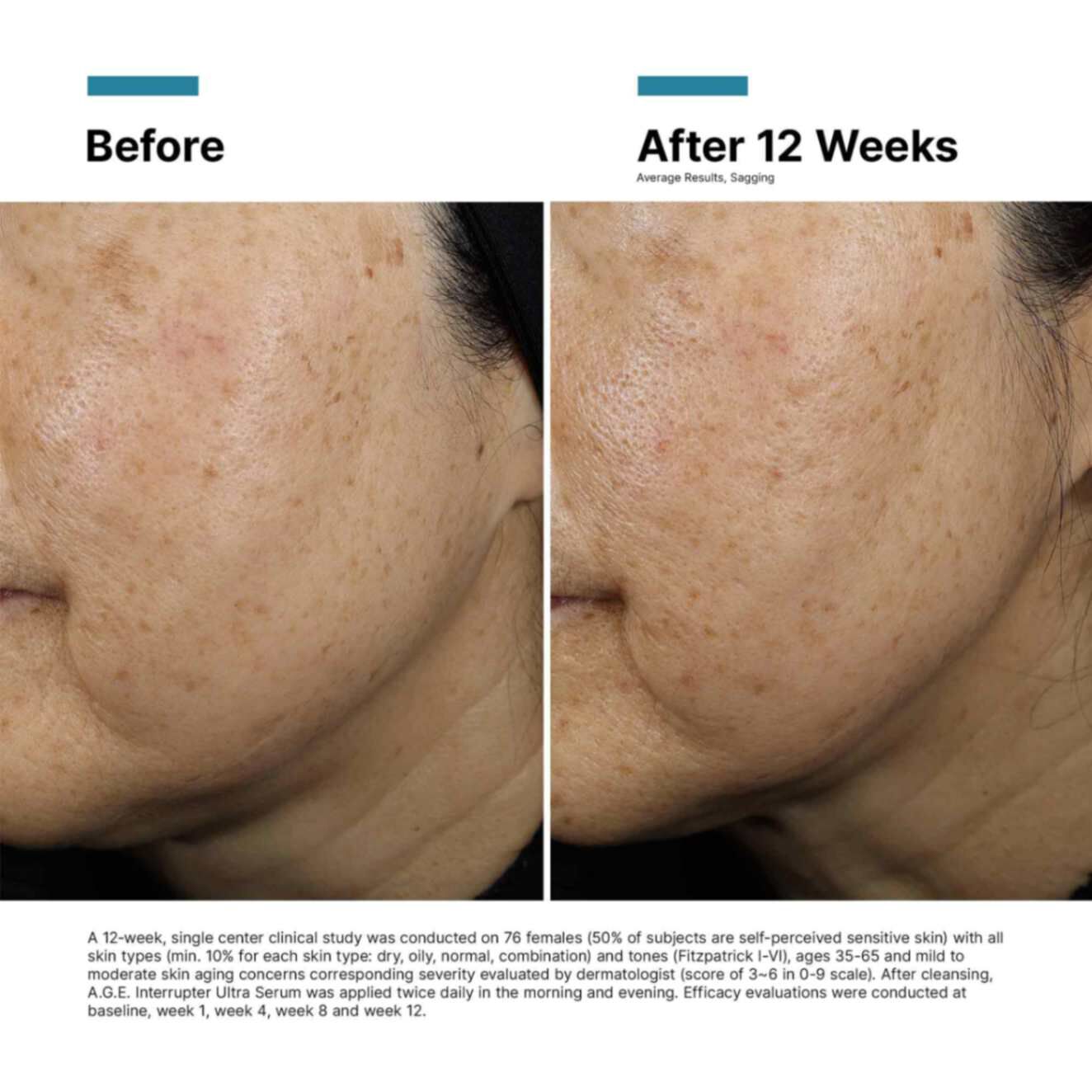 A.G.E Interrupter Ultra Skin Tightening Serum | SkinCeuticals